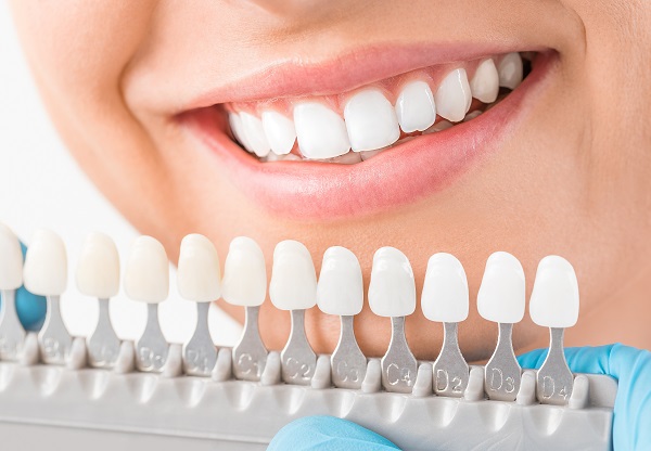 ceramic crowns tetracycline treatment