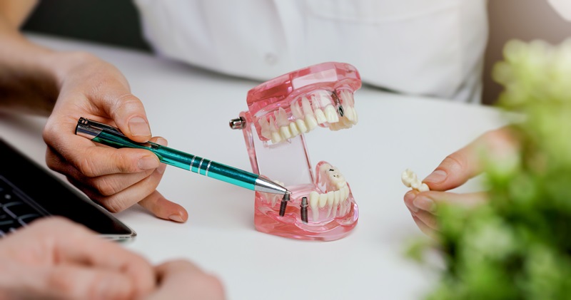 Treatment Options When Dental Implants Encounter Problems